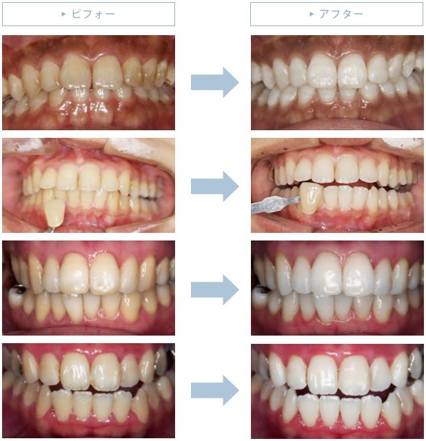 歯を白くきれいにして笑顔に自信を持ちませんか？